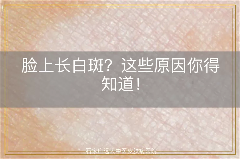 脸上长白斑？这些原因你得知道！