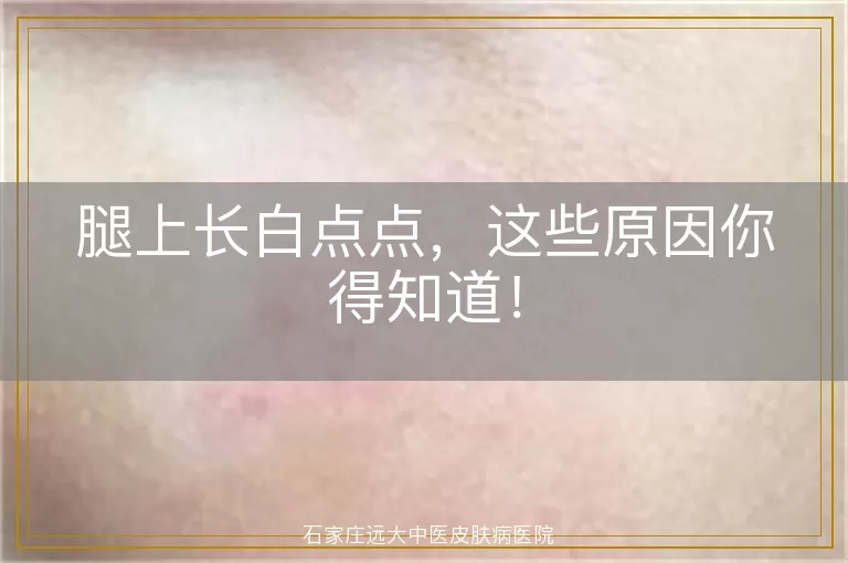 腿上长白点点，这些原因你得知道！