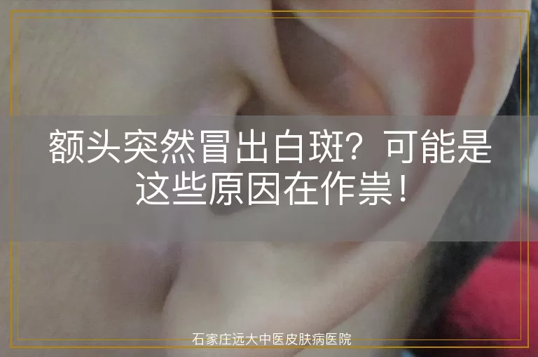 额头突然冒出白斑？可能是这些原因在作祟！