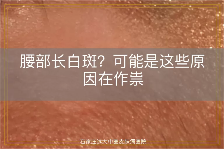 腰部长白斑？可能是这些原因在作祟