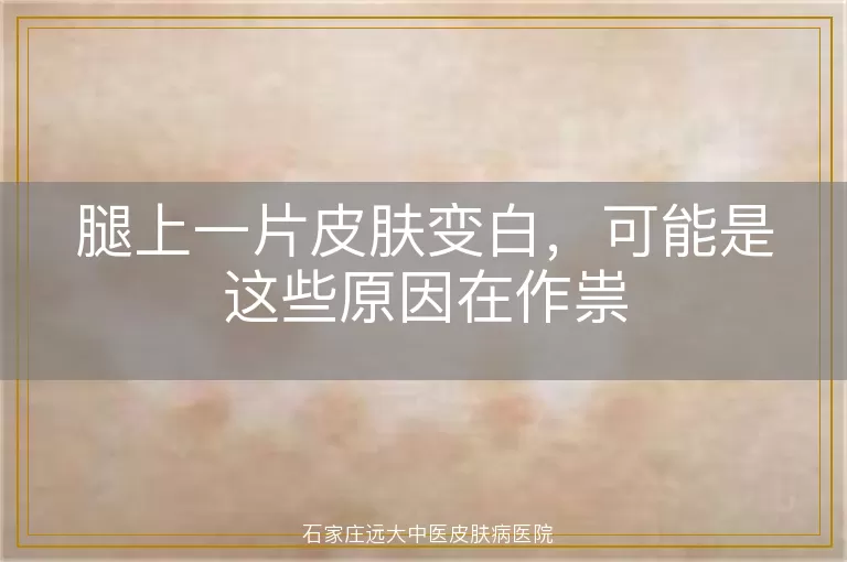 腿上一片皮肤变白，可能是这些原因在作祟
