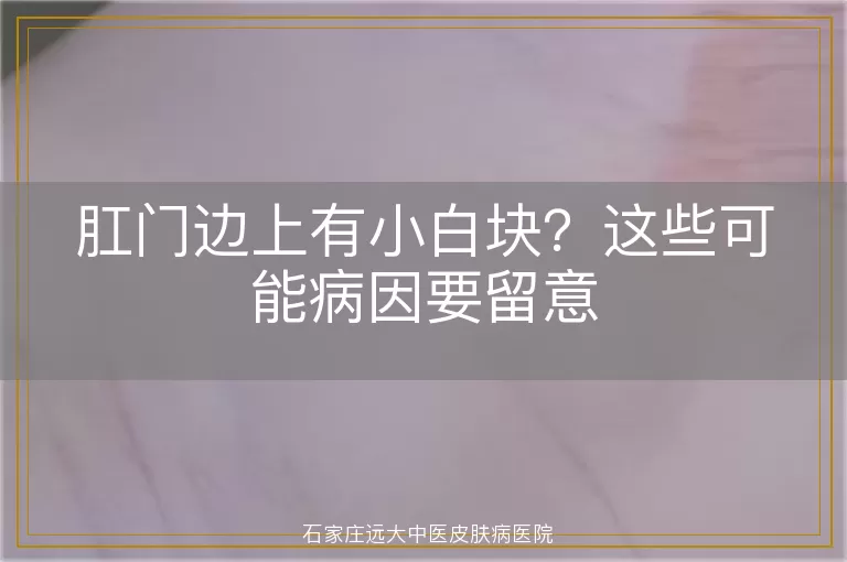 肛门边上有小白块？这些可能病因要留意