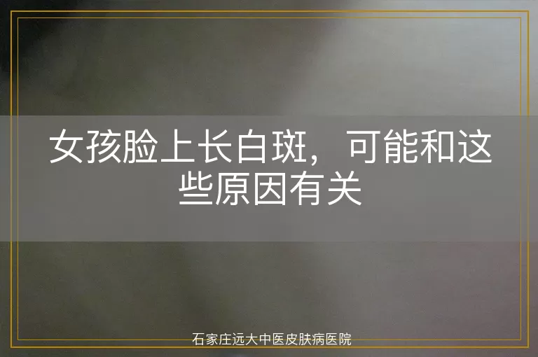 女孩脸上长白斑，可能和这些原因有关
