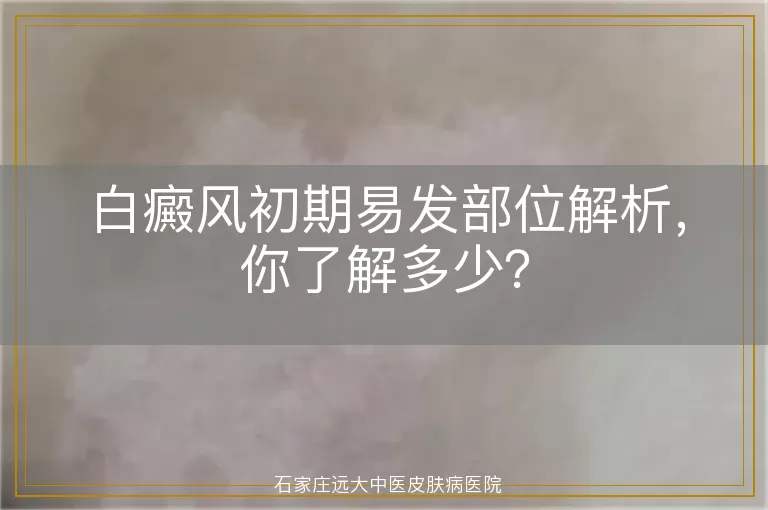 白癜风初期易发部位解析，你了解多少？