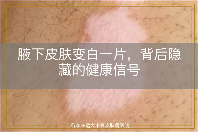 腋下皮肤变白一片，背后隐藏的健康信号