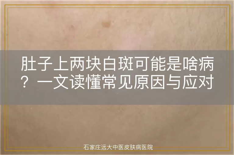 肚子上两块白斑可能是啥病？一文读懂常见原因与应对