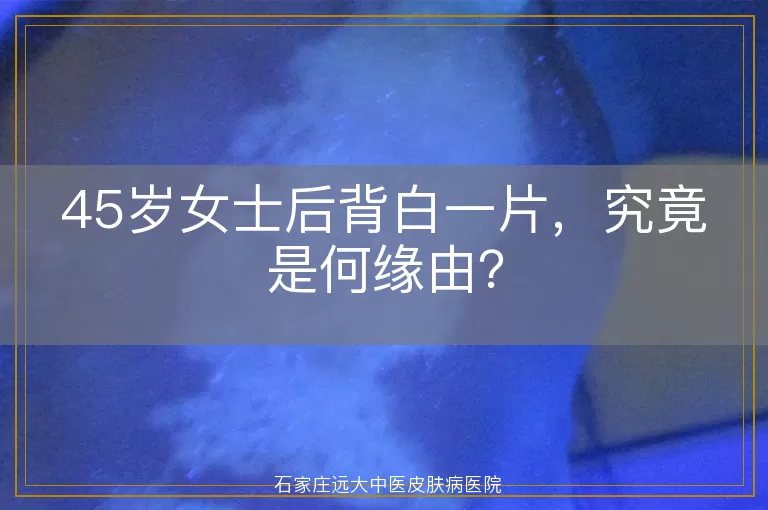 45岁女士后背白一片，究竟是何缘由？