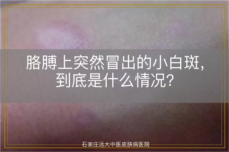 胳膊上突然冒出的小白斑，到底是什么情况？