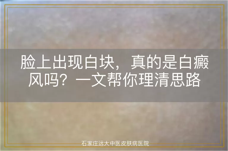 脸上出现白块，真的是白癜风吗？一文帮你理清思路
