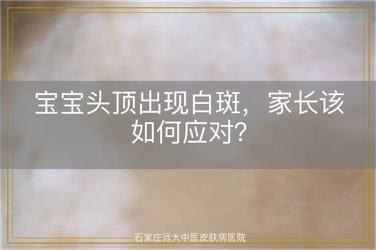 宝宝头顶出现白斑，家长该如何应对？