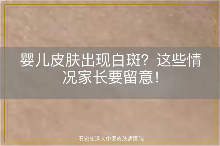 婴儿皮肤出现白斑？这些情况家长要留意！
