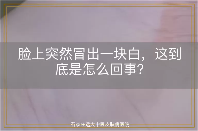 脸上突然冒出一块白，这到底是怎么回事？