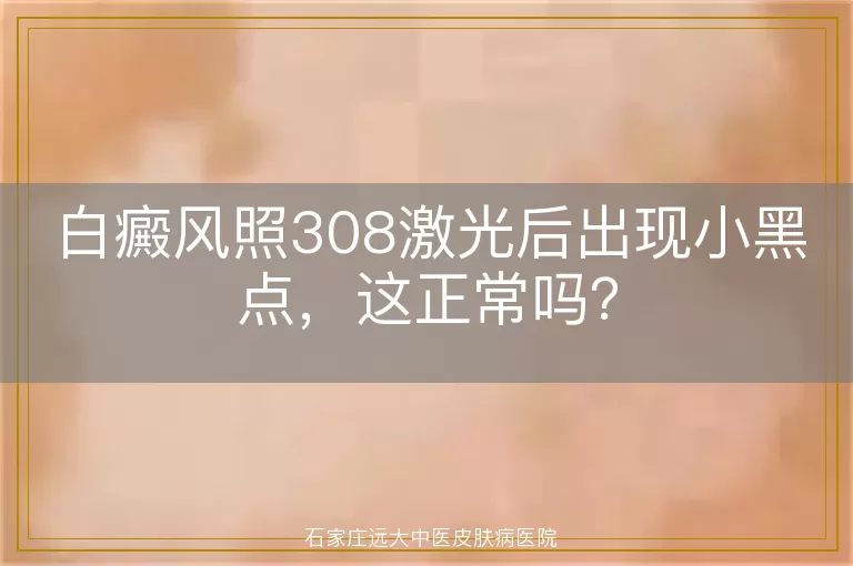 白癜风照308激光后出现小黑点，这正常吗？
