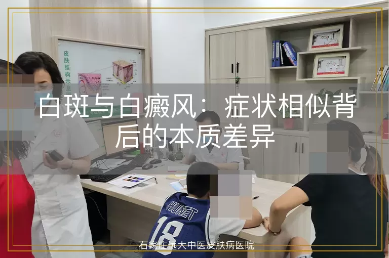 白斑与白癜风：症状相似背后的本质差异