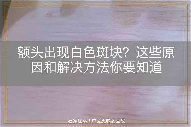 额头出现白色斑块？这些原因和解决方法你要知道