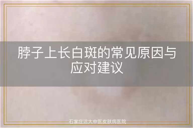 脖子上长白斑的常见原因与应对建议