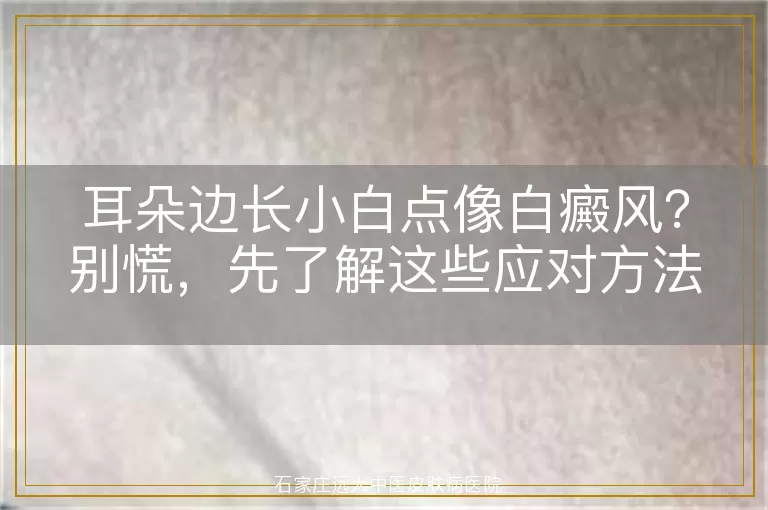 耳朵边长小白点像白癜风？别慌，先了解这些应对方法