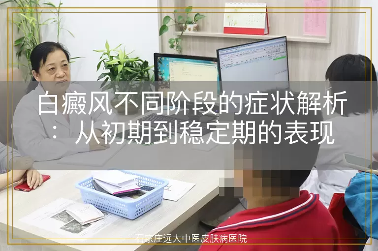 白癜风不同阶段的症状解析：从初期到稳定期的表现