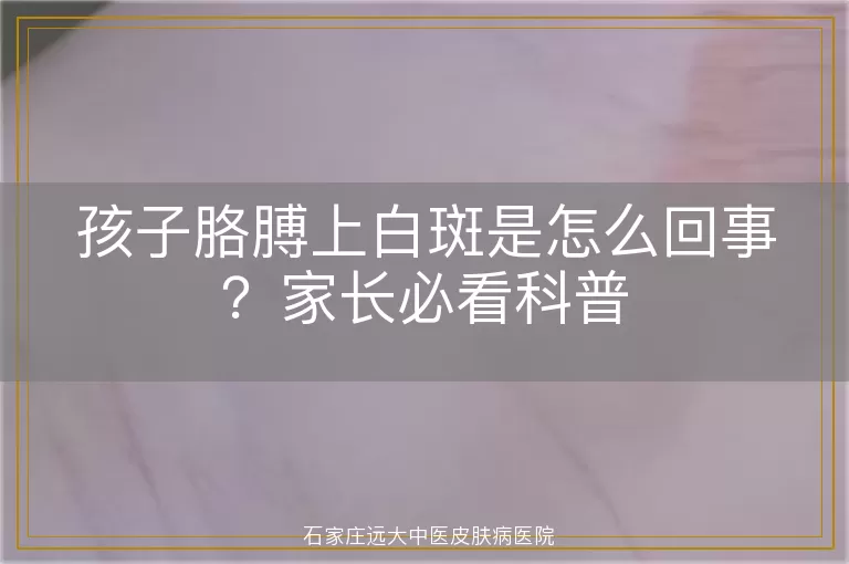 孩子胳膊上白斑是怎么回事？家长必看科普