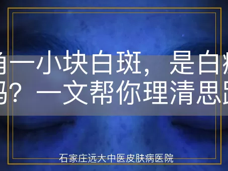 嘴角一小块白斑，是白癜风吗？一文帮你理清思路