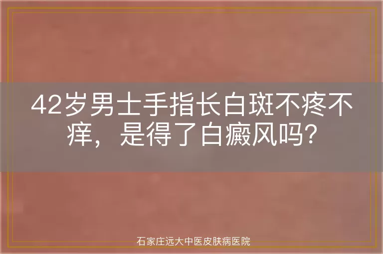 42岁男士手指长白斑不疼不痒，是得了白癜风吗？