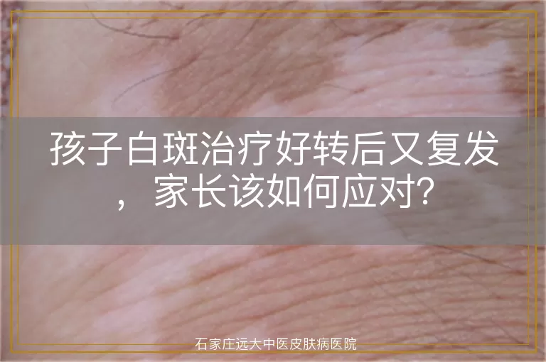 孩子白斑治疗好转后又复发，家长该如何应对？