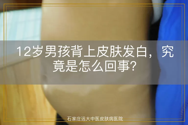 12岁男孩背上皮肤发白，究竟是怎么回事？
