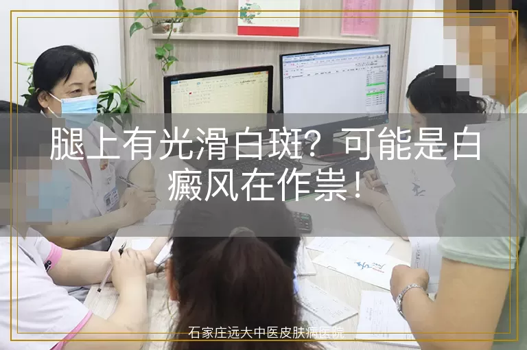 腿上有光滑白斑？可能是白癜风在作祟！