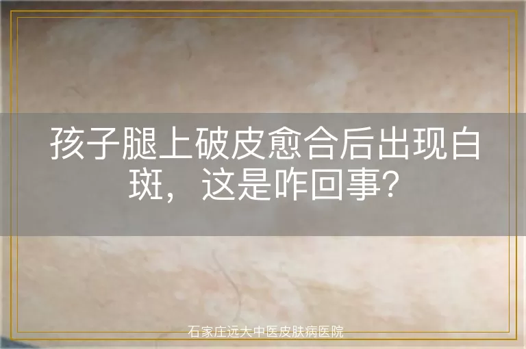 孩子腿上破皮愈合后出现白斑，这是咋回事？