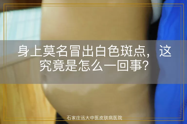 身上莫名冒出白色斑点，这究竟是怎么一回事？