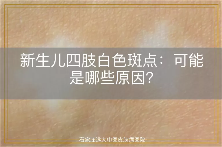 新生儿四肢白色斑点：可能是哪些原因？