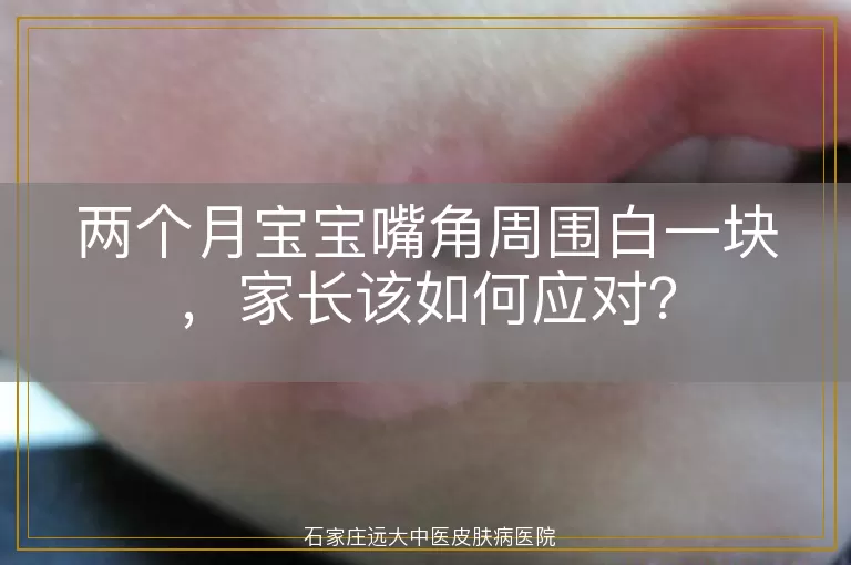 两个月宝宝嘴角周围白一块，家长该如何应对？