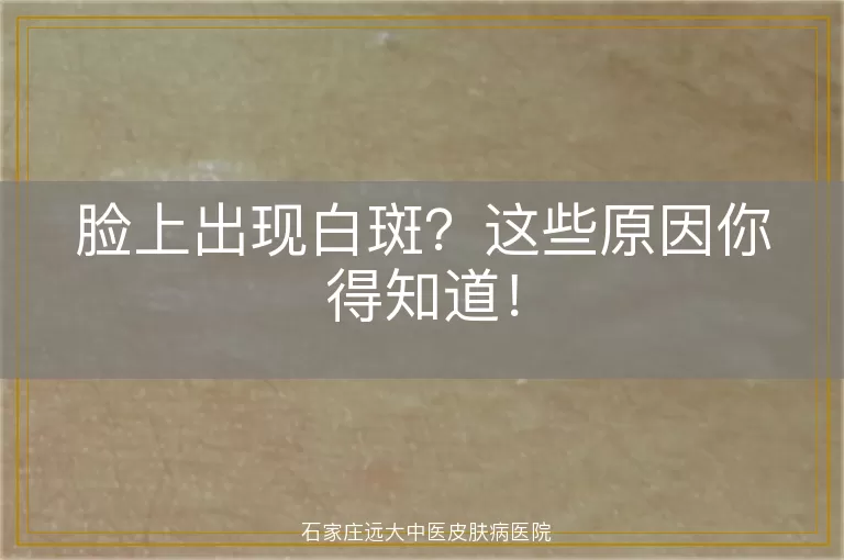 脸上出现白斑？这些原因你得知道！