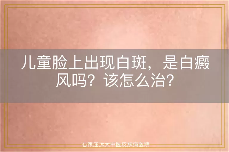 儿童脸上出现白斑，是白癜风吗？该怎么治？