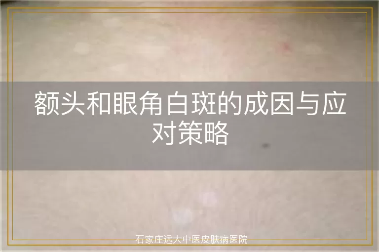 额头和眼角白斑的成因与应对策略