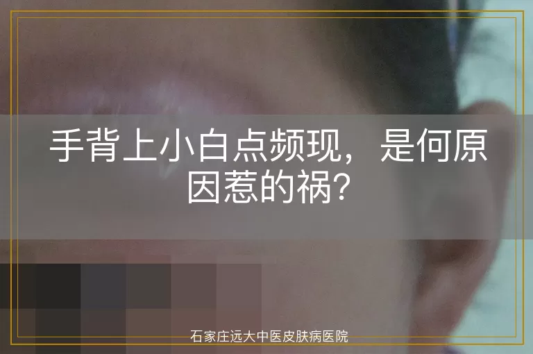 手背上小白点频现，是何原因惹的祸？