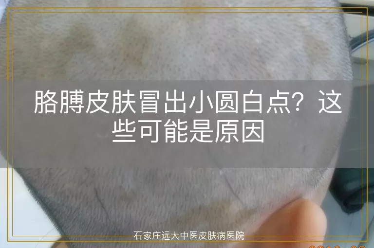 胳膊皮肤冒出小圆白点？这些可能是原因
