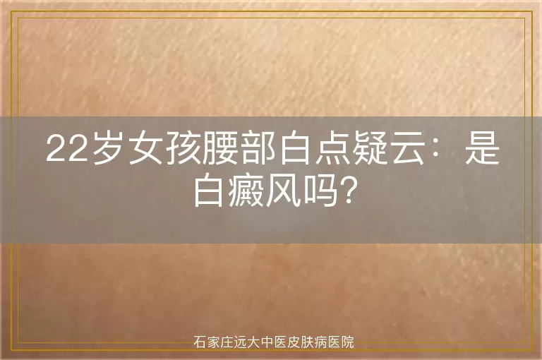 22岁女孩腰部白点疑云：是白癜风吗？