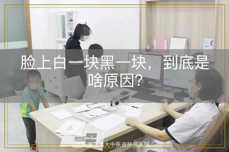 脸上白一块黑一块，到底是啥原因？