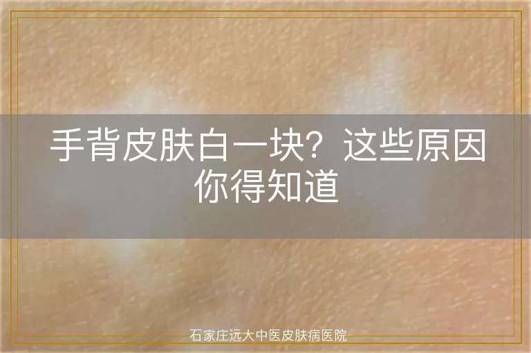 手背皮肤白一块？这些原因你得知道