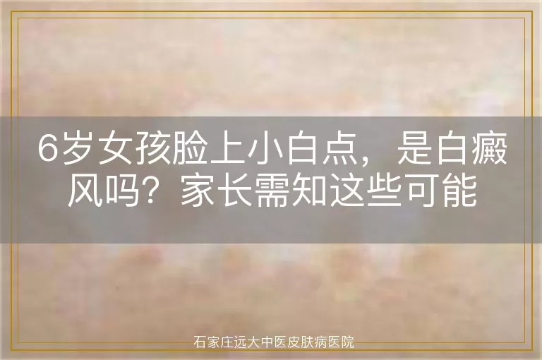 6岁女孩脸上小白点，是白癜风吗？家长需知这些可能
