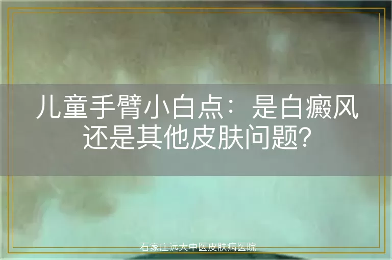 儿童手臂小白点:是白癜风还是其他皮肤问题?