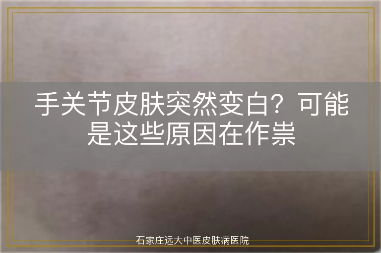 手关节皮肤突然变白？可能是这些原因在作祟