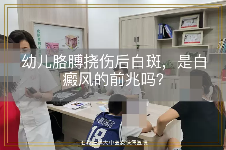 幼儿胳膊挠伤后白斑，是白癜风的前兆吗？