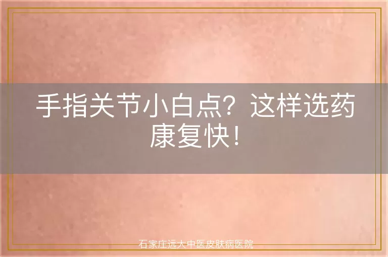手指关节小白点？这样选药康复快！