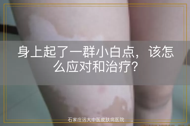 身上起了一群小白点，该怎么应对和治疗？