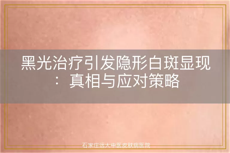 黑光治疗引发隐形白斑显现：真相与应对策略