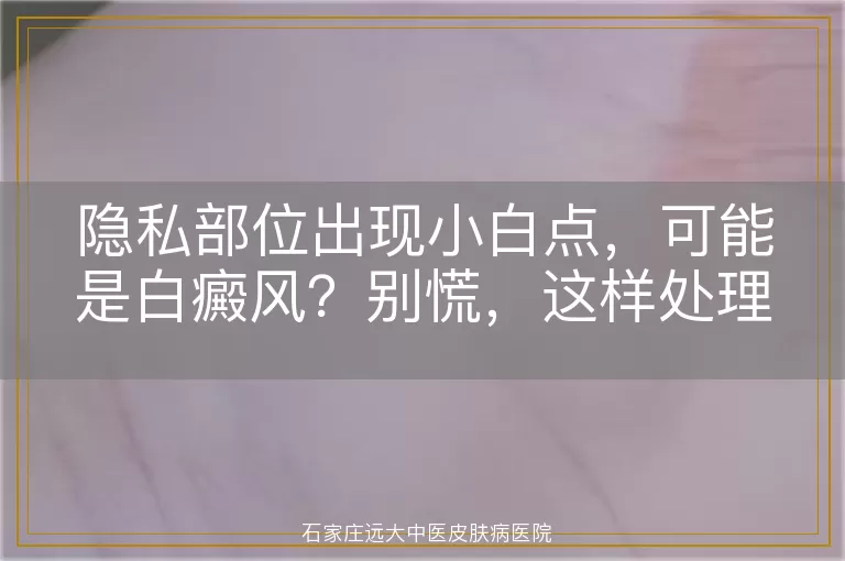 隐私部位出现小白点，可能是白癜风？别慌，这样处理！