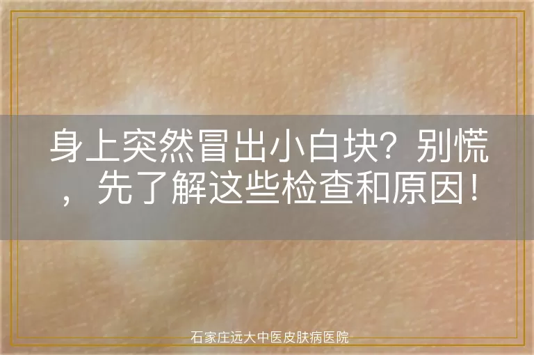 身上突然冒出小白块？别慌，先了解这些检查和原因！