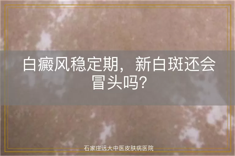 白癜风稳定期，新白斑还会冒头吗？